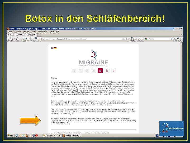 Botox in den Schläfenbereich! Botox in den Schläfenbereich!
