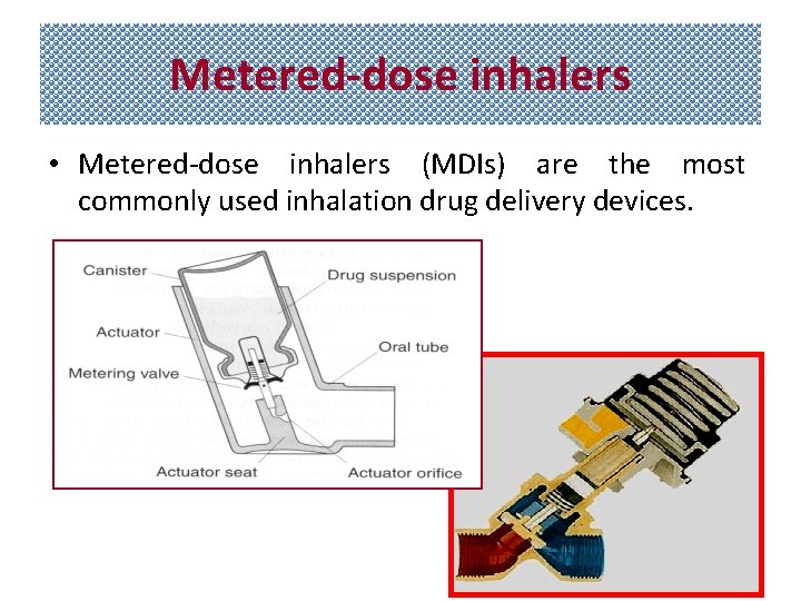 Metered dose inhalers • Metered-dose inhalers (MDIs) are the most commonly used inhalation drug
