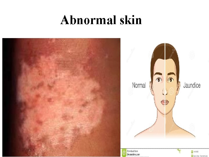 Abnormal skin 