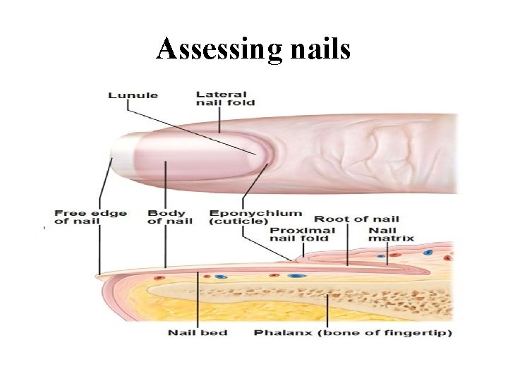 Assessing nails 