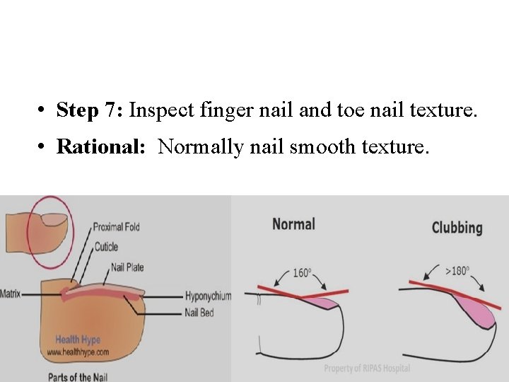  • Step 7: Inspect finger nail and toe nail texture. • Rational: Normally