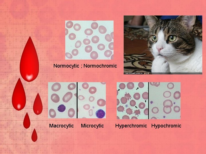 Normocytic ; Normochromic Macrocytic Microcytic Hyperchromic Hypochromic 