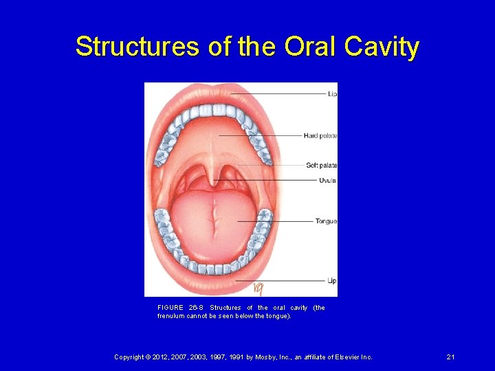 Structures of the Oral Cavity FIGURE 26 -8 Structures of the oral cavity (the