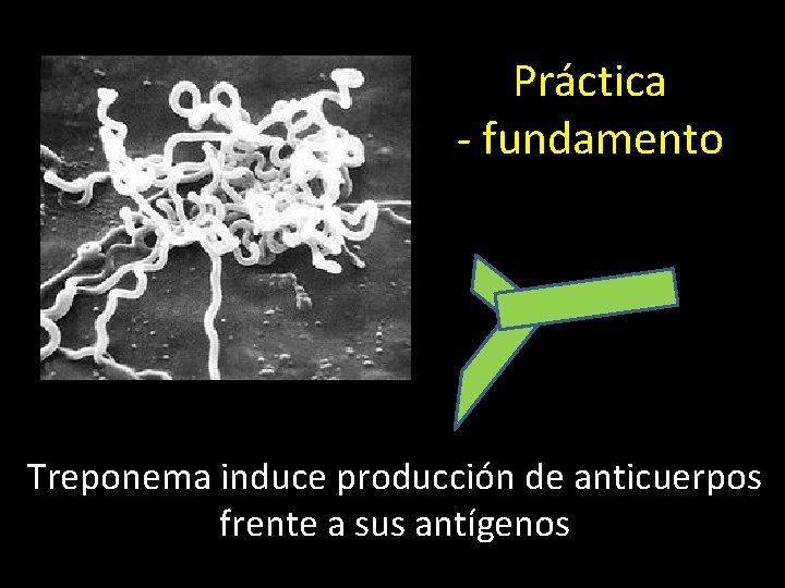 Práctica - fundamento Treponema induce producción de anticuerpos frente a sus antígenos 