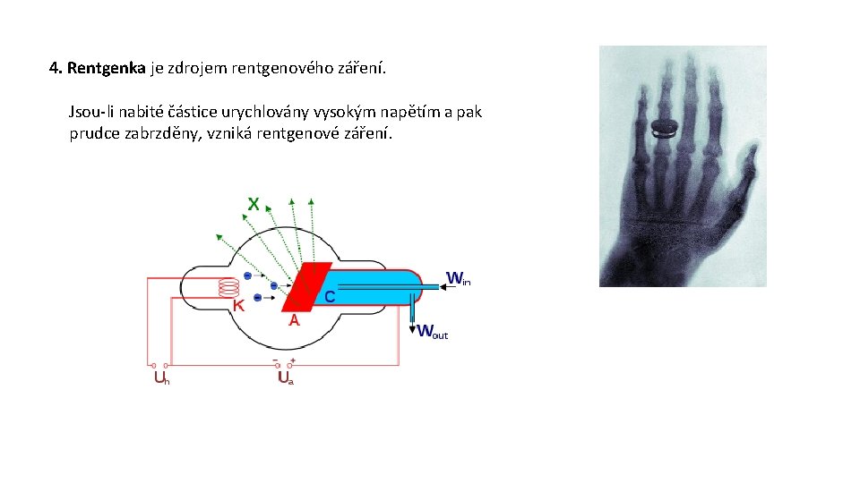 4. Rentgenka je zdrojem rentgenového záření. Jsou-li nabité částice urychlovány vysokým napětím a pak