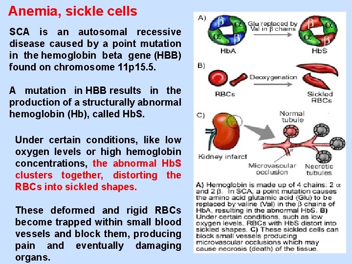 Anemia, sickle cells SCA is an autosomal recessive disease caused by a point mutation