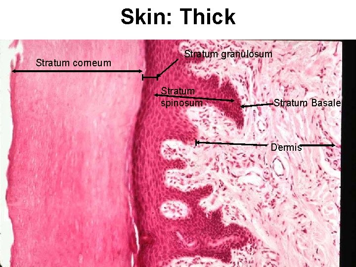 Skin: Thick Stratum corneum Stratum granulosum Stratum spinosum Stratum Basale Dermis 
