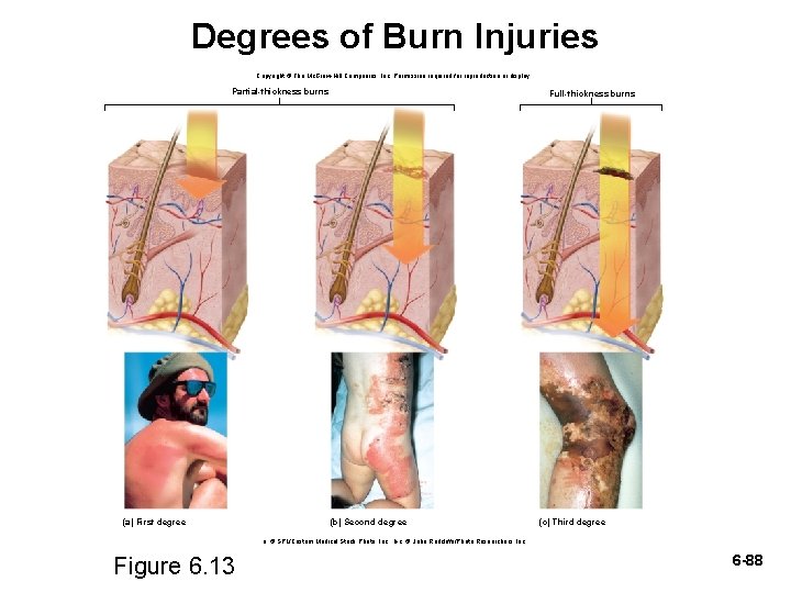Degrees of Burn Injuries Copyright © The Mc. Graw-Hill Companies, Inc. Permission required for