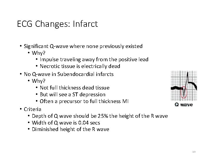 ECG Changes: Infarct • Significant Q-wave where none previously existed • Why? • Impulse