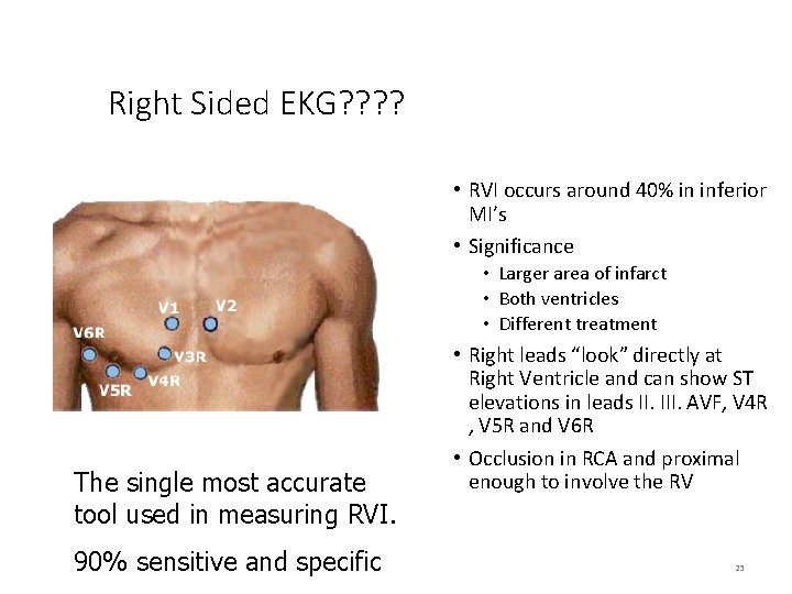 Right Sided EKG? ? • RVI occurs around 40% in inferior MI’s • Significance