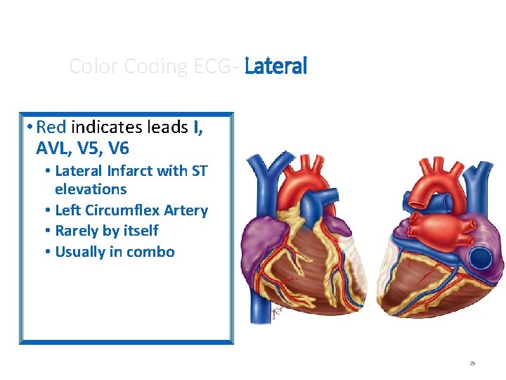 Color Coding ECG- Lateral • Red indicates leads I, AVL, V 5, V 6