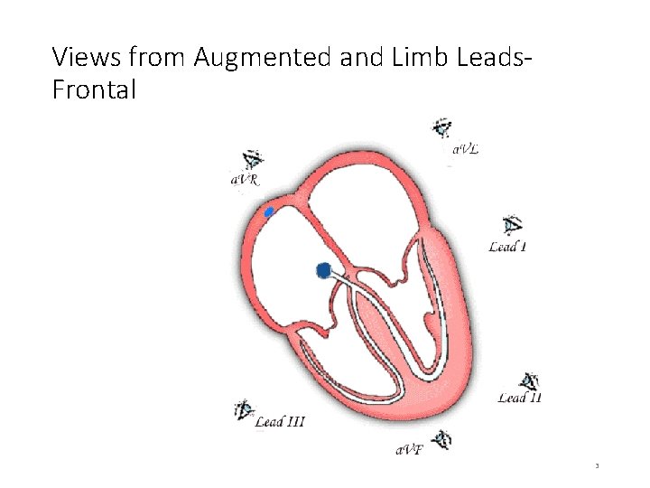 Views from Augmented and Limb Leads. Frontal 3 