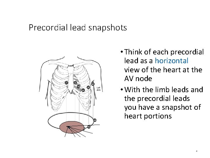 Precordial lead snapshots • Think of each precordial lead as a horizontal view of