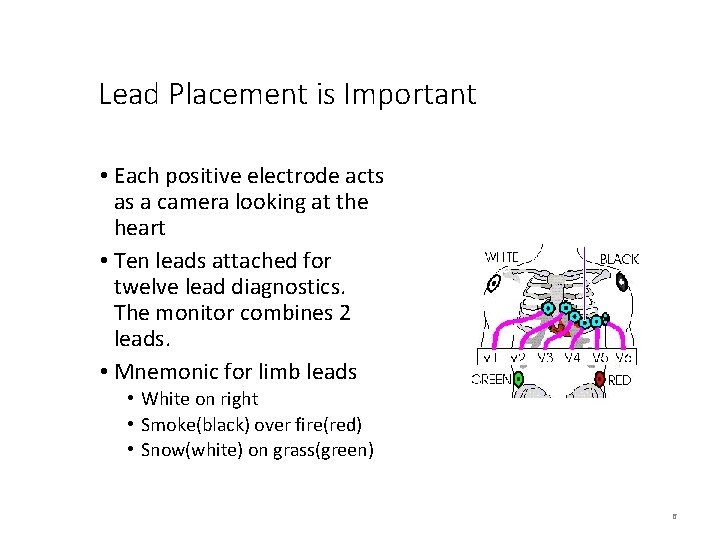 Lead Placement is Important • Each positive electrode acts as a camera looking at