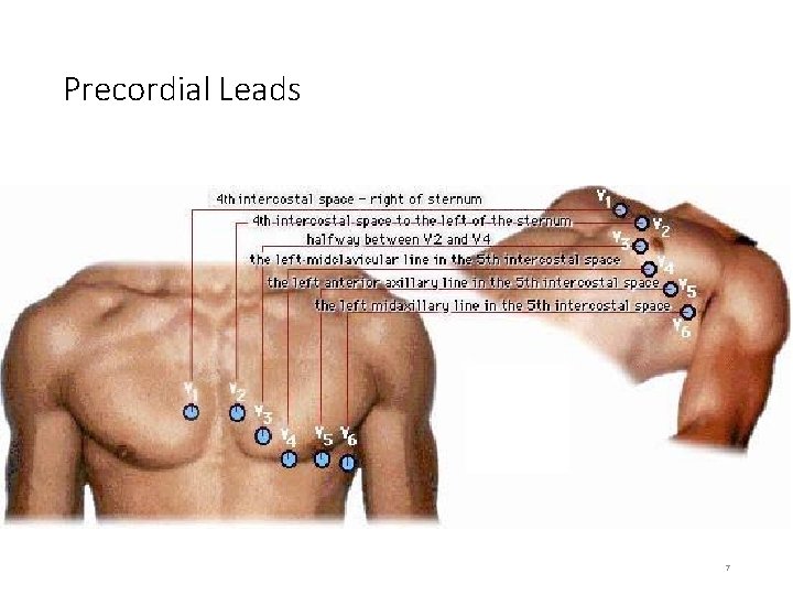 Precordial Leads 7 