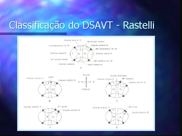 Classificação do DSAVT - Rastelli 