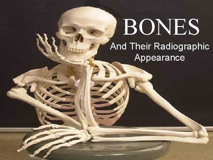 BONES And Their Radiographic Appearance 