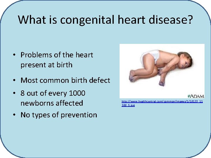 What is congenital heart disease? • Problems of the heart present at birth •