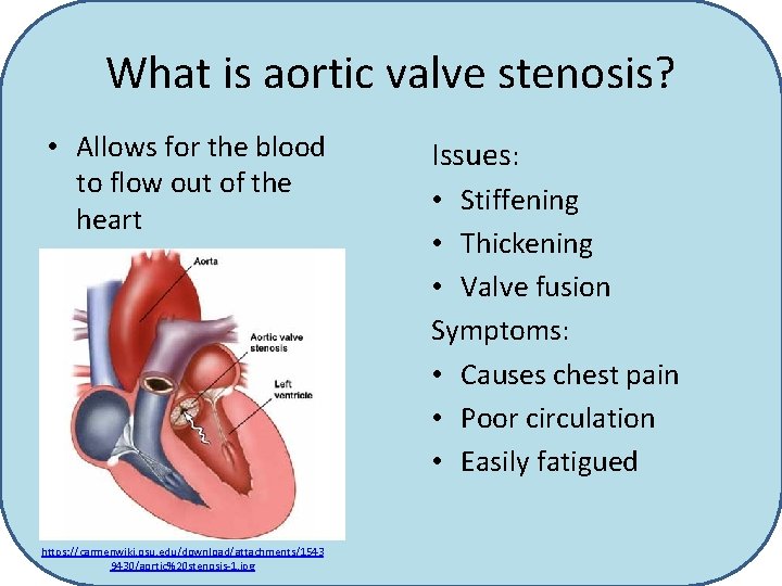 What is aortic valve stenosis? • Allows for the blood to flow out of