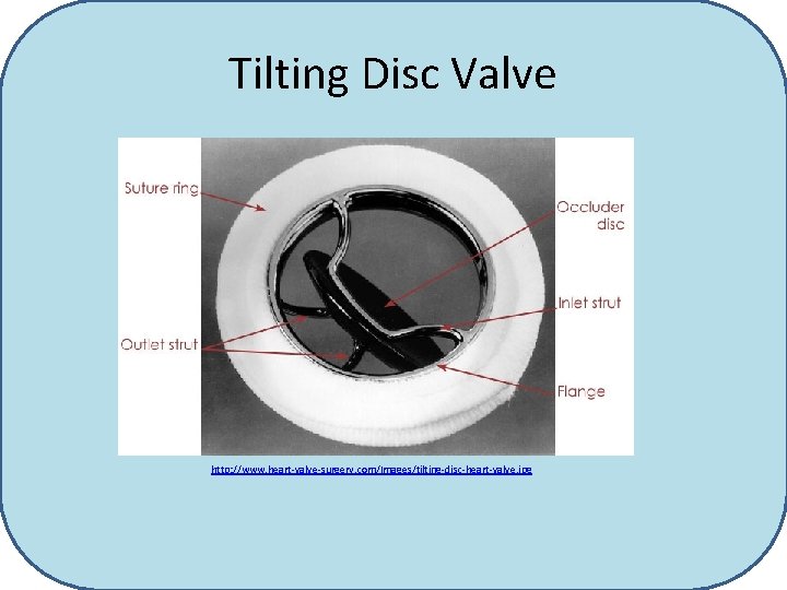Tilting Disc Valve http: //www. heart-valve-surgery. com/Images/tilting-disc-heart-valve. jpg 