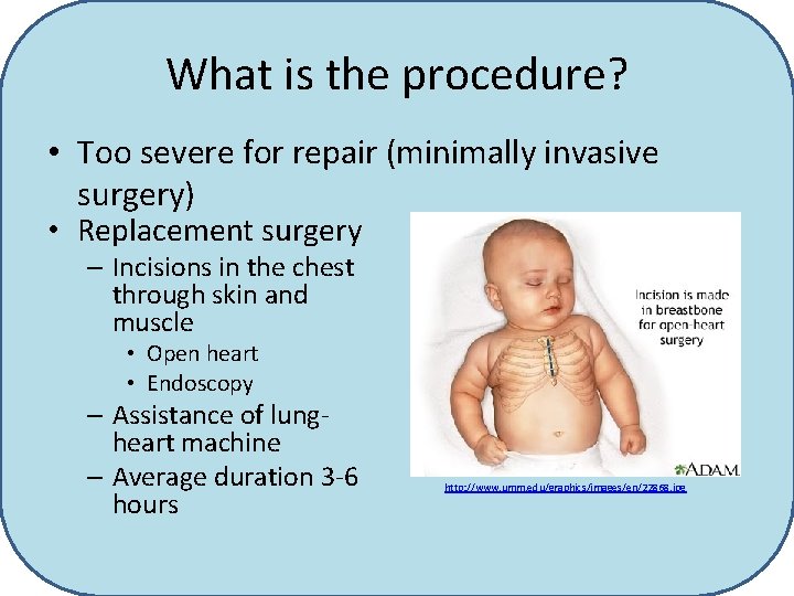 What is the procedure? • Too severe for repair (minimally invasive surgery) • Replacement