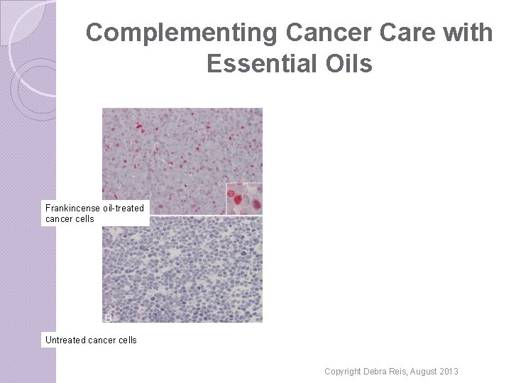 Complementing Cancer Care with Essential Oils Frankincense oil-treated cancer cells Untreated cancer cells Copyright