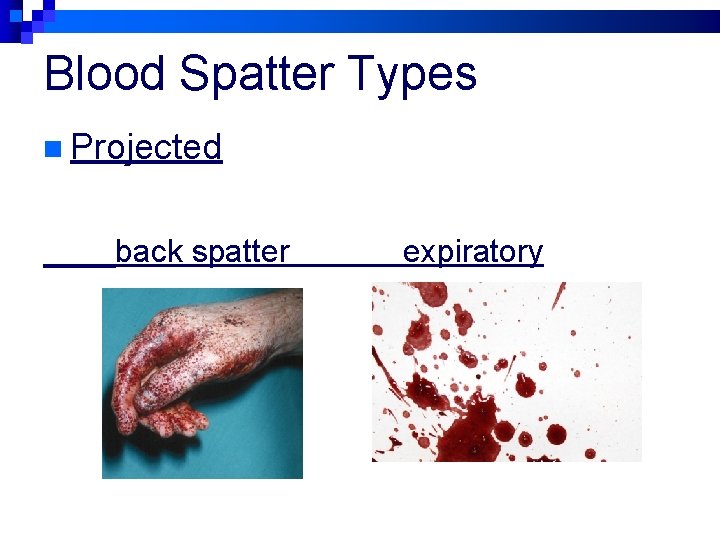 Blood Spatter Types n Projected back spatter expiratory 