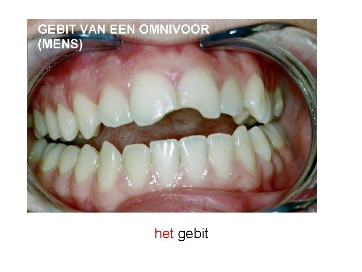 het gebit 