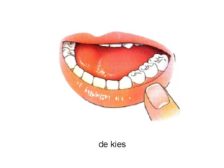 de kies 