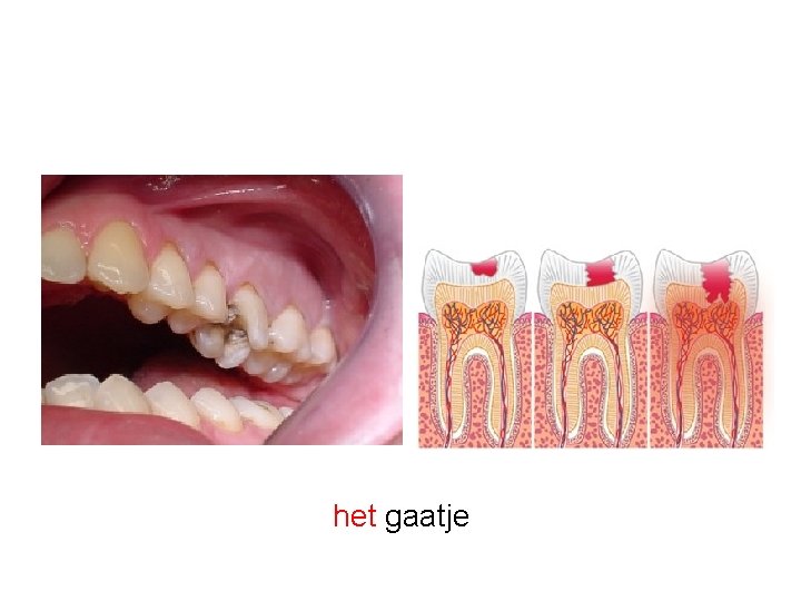 het gaatje 