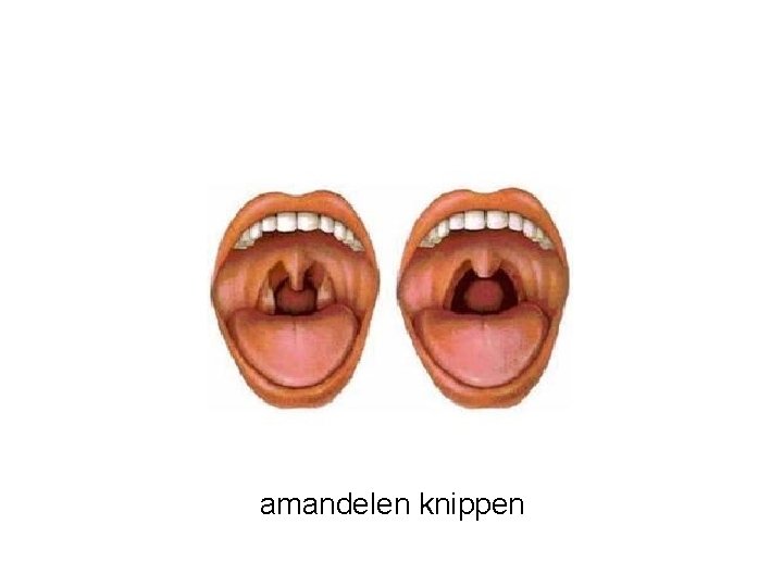 amandelen knippen 
