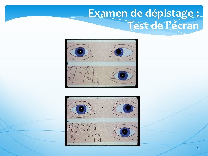 Examen de dépistage : Test de l’écran 93 