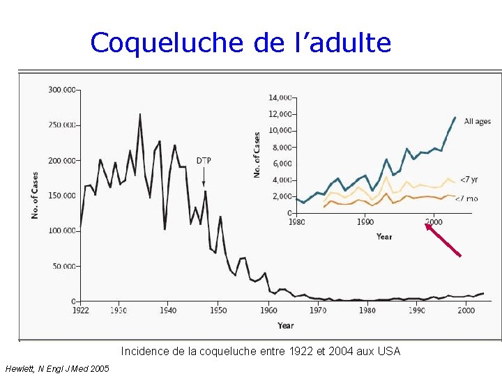 Coqueluche de l’adulte Incidence de la coqueluche entre 1922 et 2004 aux USA Hewlett,