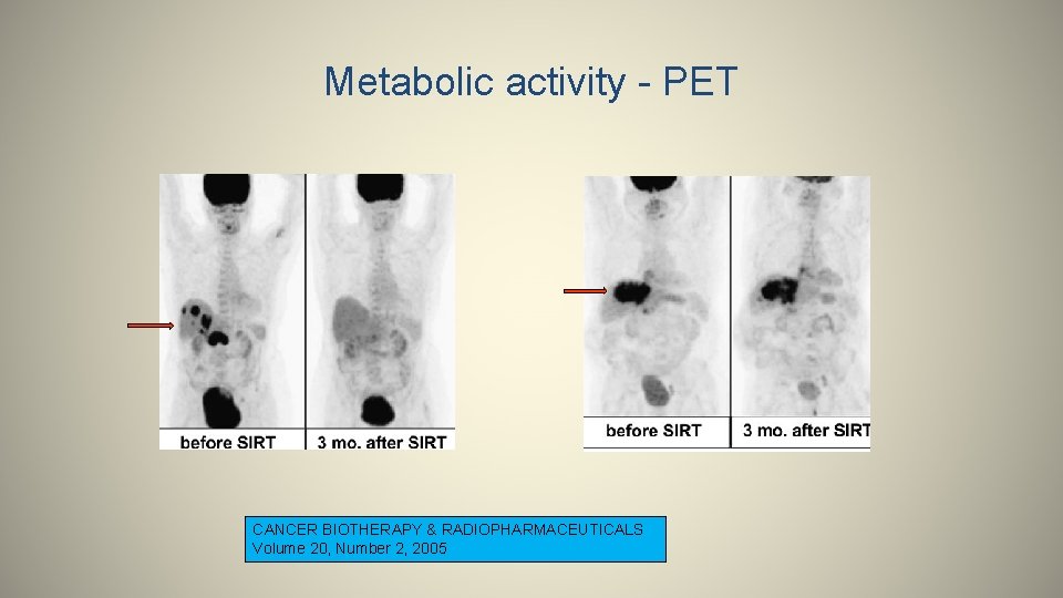 Metabolic activity - PET CANCER BIOTHERAPY & RADIOPHARMACEUTICALS Volume 20, Number 2, 2005 