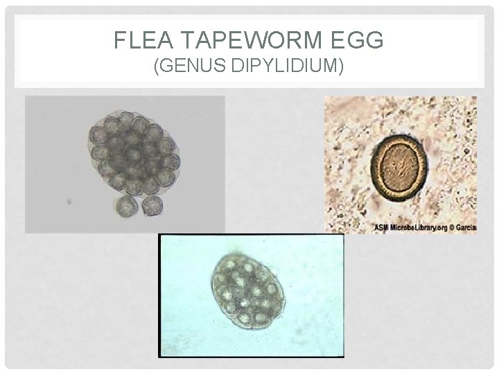 FLEA TAPEWORM EGG (GENUS DIPYLIDIUM) 