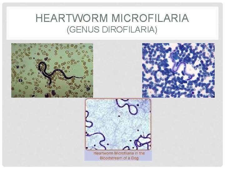 HEARTWORM MICROFILARIA (GENUS DIROFILARIA) 