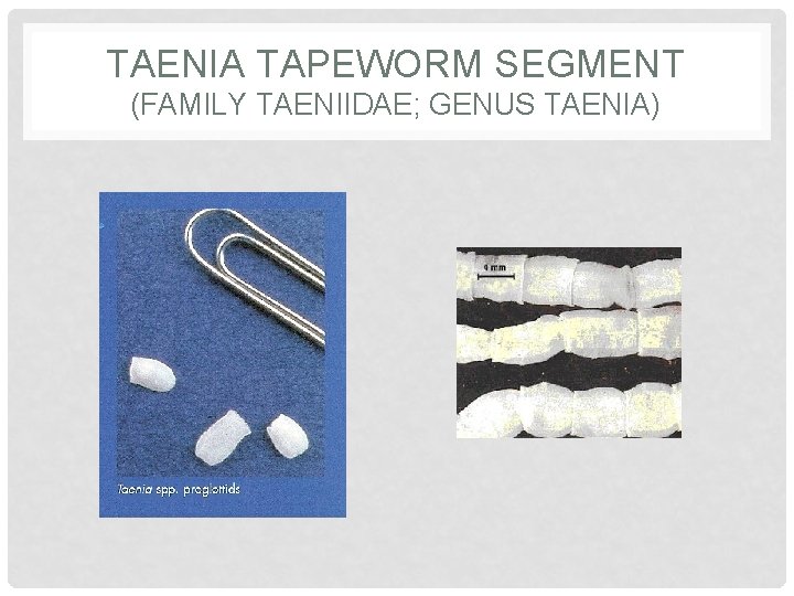 TAENIA TAPEWORM SEGMENT (FAMILY TAENIIDAE; GENUS TAENIA) 
