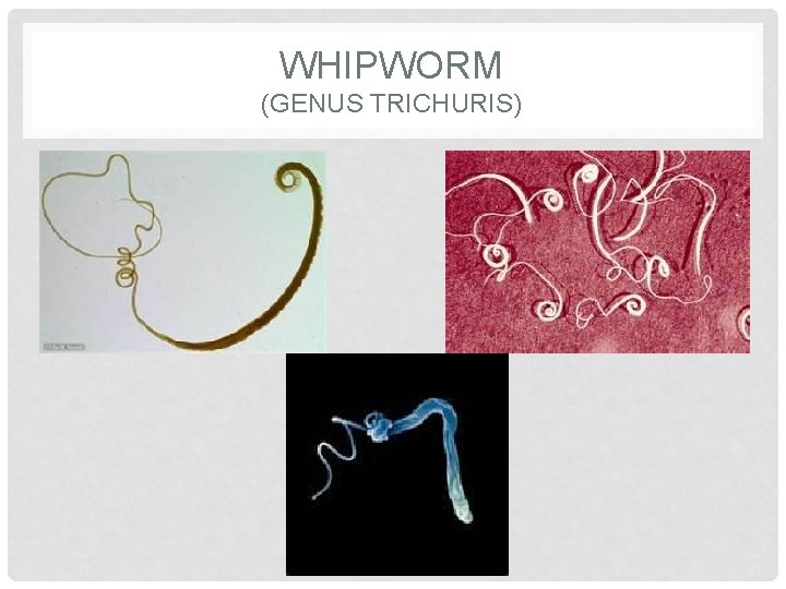 WHIPWORM (GENUS TRICHURIS) 
