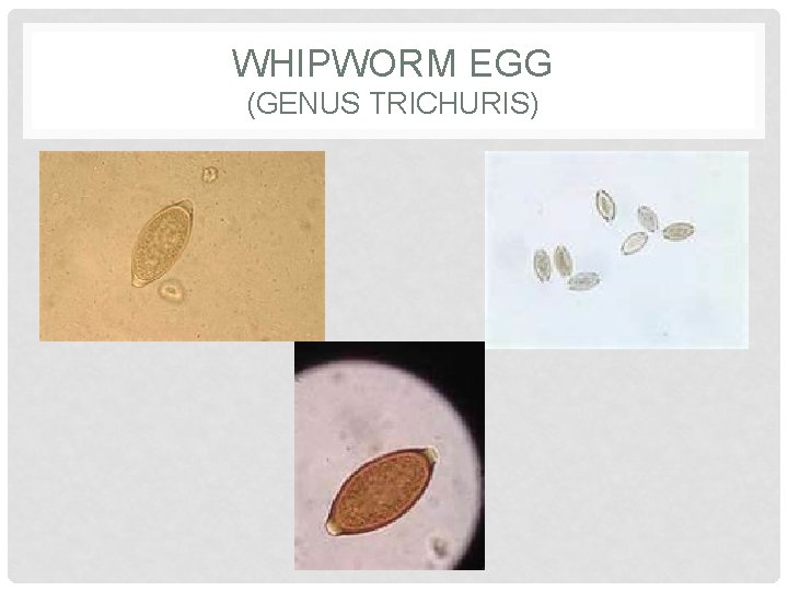 WHIPWORM EGG (GENUS TRICHURIS) 