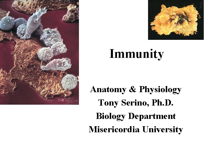 Immunity Anatomy & Physiology Tony Serino, Ph. D. Biology Department Misericordia University 