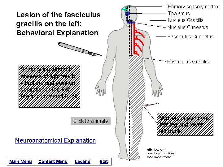 Lesion of the fasciculus gracilis on the left: Behavioral Explanation Primary sensory cortex Thalamus