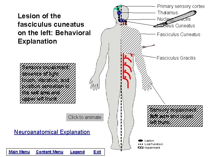 Primary sensory cortex Thalamus Nucleus Gracilis Nucleus Cuneatus Lesion of the fasciculus cuneatus on