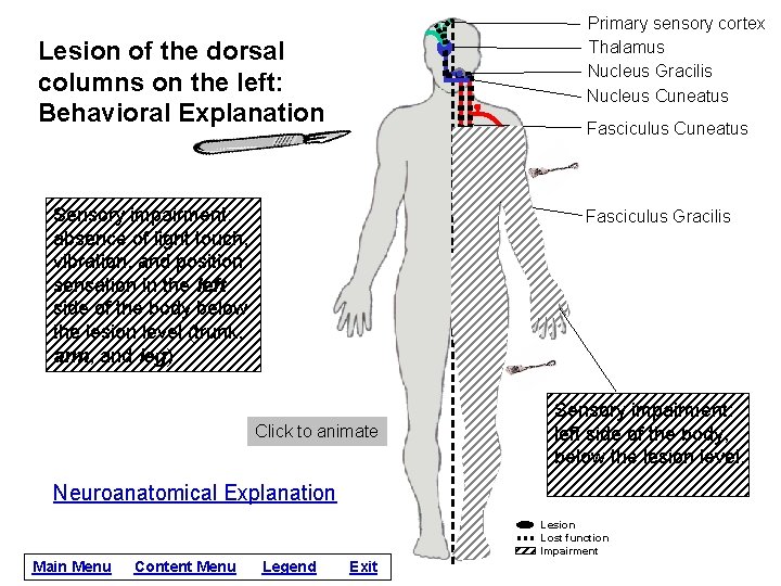 Primary sensory cortex Thalamus Nucleus Gracilis Nucleus Cuneatus Lesion of the dorsal columns on