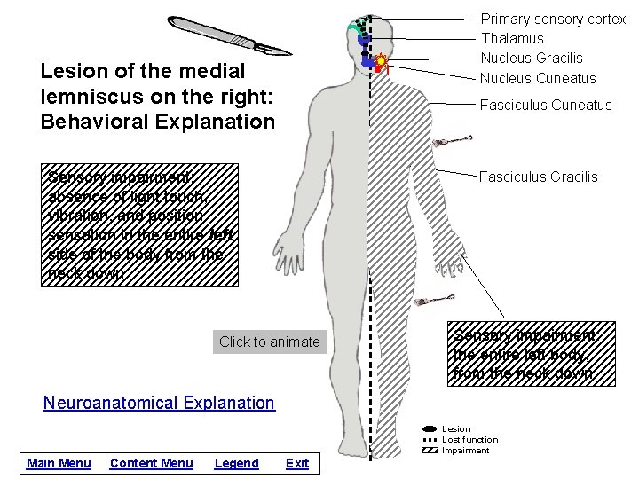 Primary sensory cortex Thalamus Nucleus Gracilis Nucleus Cuneatus Lesion of the medial lemniscus on