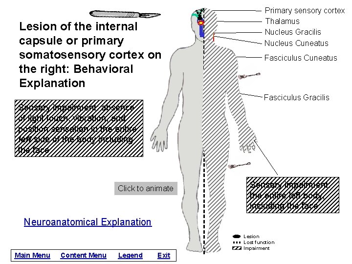 Lesion of the internal capsule or primary somatosensory cortex on the right: Behavioral Explanation