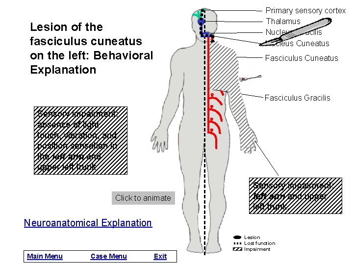 Primary sensory cortex Thalamus Nucleus Gracilis Nucleus Cuneatus Lesion of the fasciculus cuneatus on