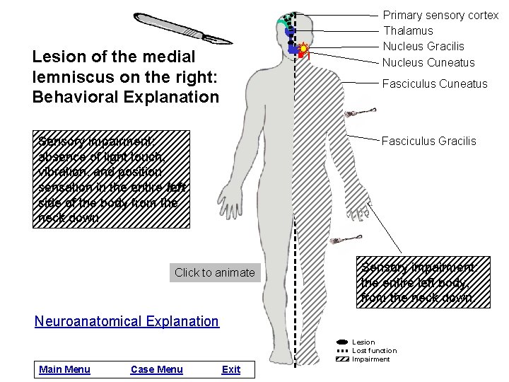 Primary sensory cortex Thalamus Nucleus Gracilis Nucleus Cuneatus Lesion of the medial lemniscus on