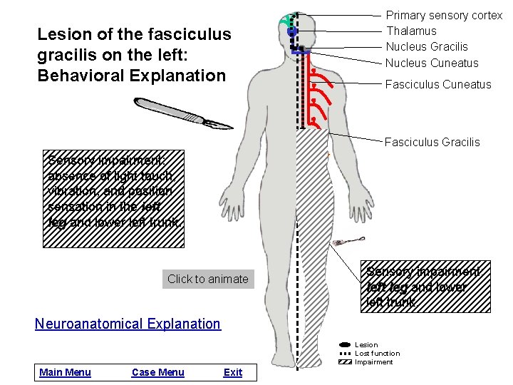 Lesion of the fasciculus gracilis on the left: Behavioral Explanation Primary sensory cortex Thalamus