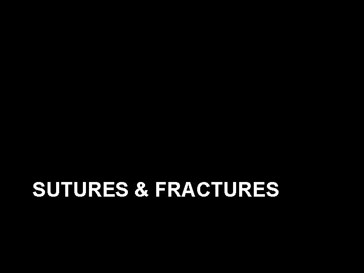 SUTURES & FRACTURES 