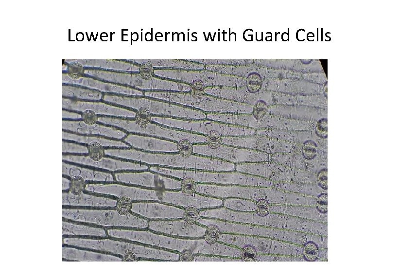 Lower Epidermis with Guard Cells 